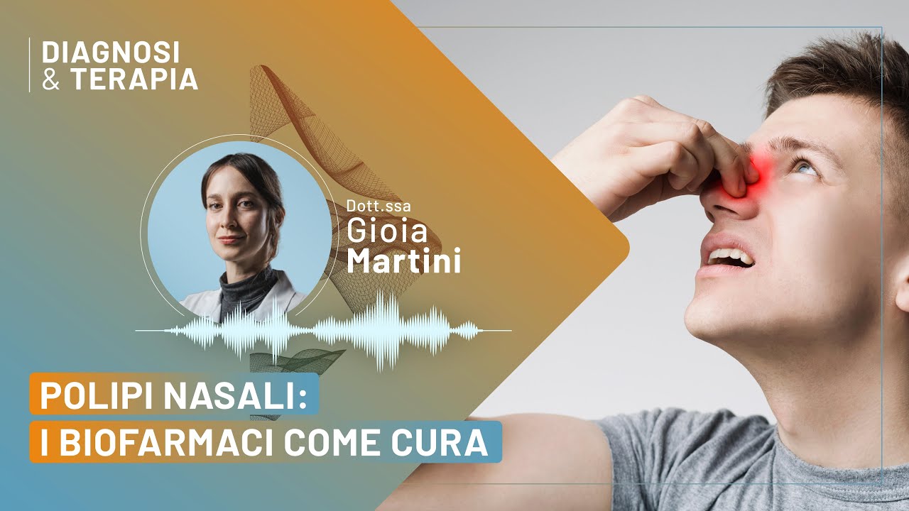 Polipi nasali: curarli con i biofarmaci - Dott.ssa Gioia Martini