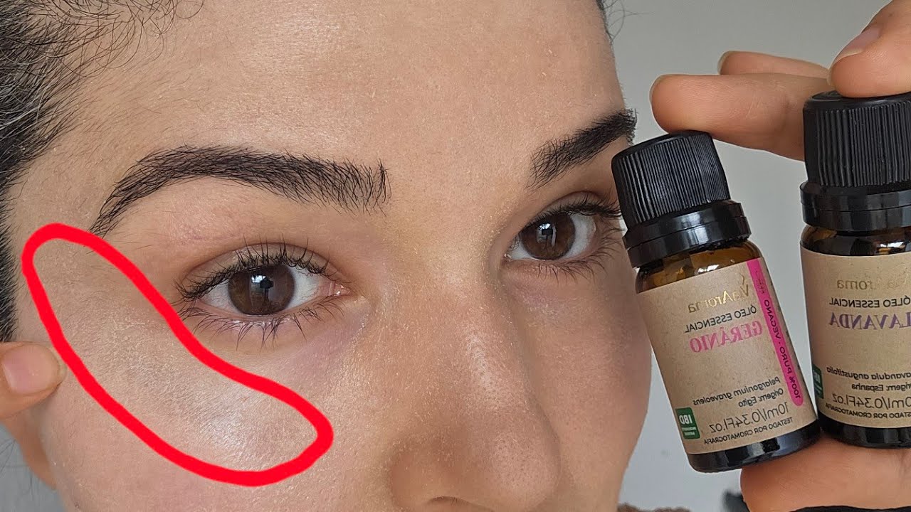 🚫 Cuidado ao usar óleo essencial na pele, veja o que aconteceu comigo 😲