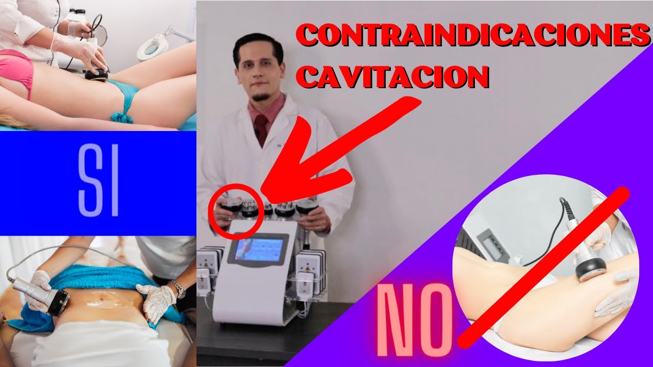 CONTRAINDICACIONES CAVITACIÓN