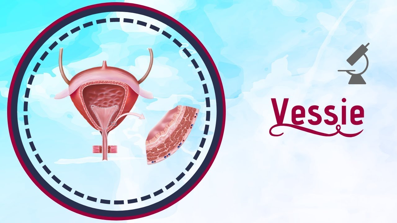 Anatomie de la vessie, cancer v&eacute;sical et lithiases
