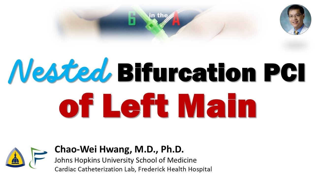 Nested Bifurcation Stenting of Left Main Trifurcation