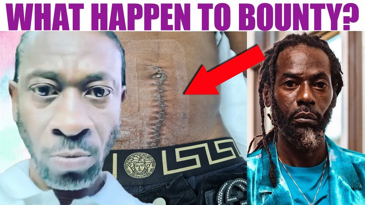 OMG! BOUNTY SHOCKING SURGERY | Buju Rushed About Visa | General Ginger New Music