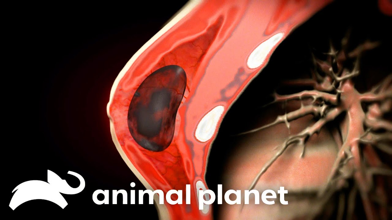Infected Breast Implants Causes A Woman's Body to Shut Down | Monsters Inside Me | Animal Planet