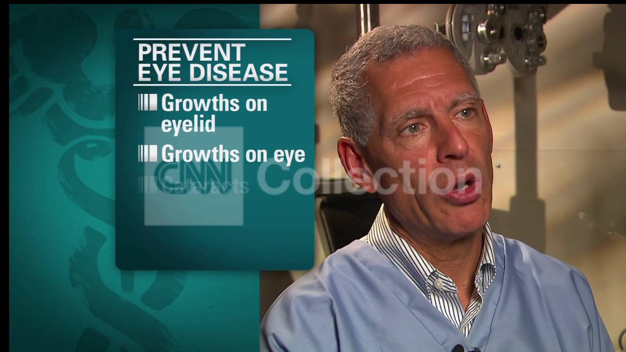 HEALTH MINUTE:SUN DANGER EYES (RE-RUN)