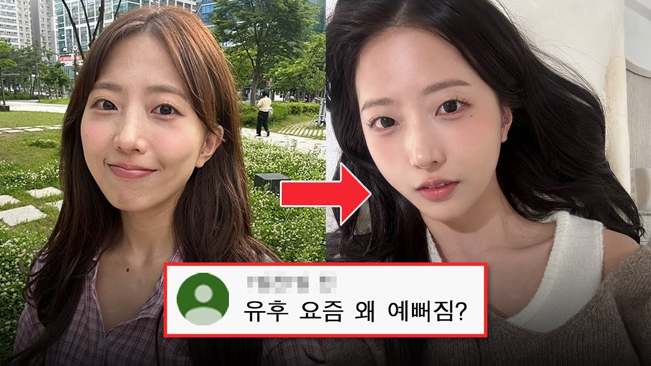 성형? 시술? 최근 6개월간의 변화과정 모두 알려드림