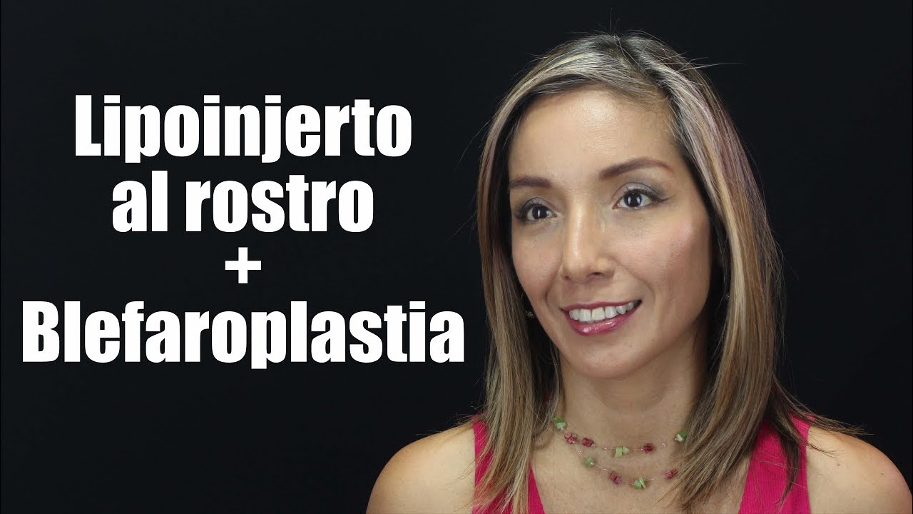 LIPOINJERTO en rostro y Cirugía de PÁRPADOS 👀 Blefaroplastia 💯 Dr Percy Nevado Cirugía