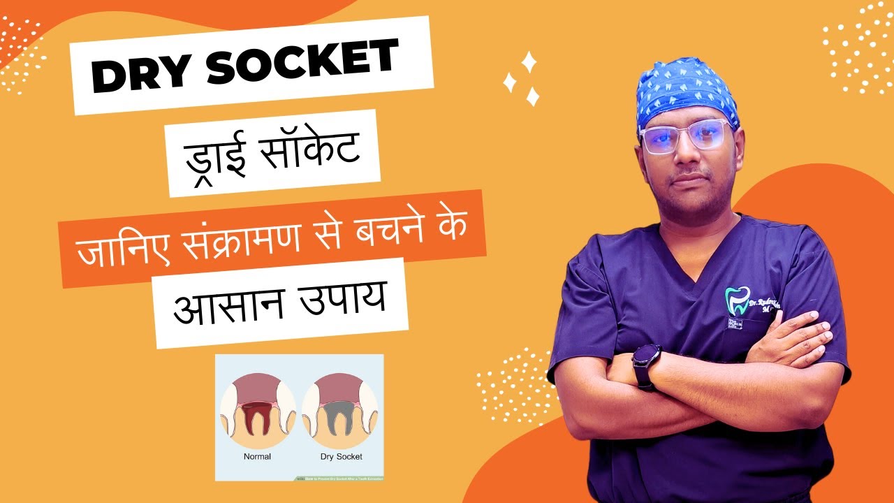 Dr Rudra Mohan |ड्राई सॉकेट: जानिए संक्रामण से बचने के आसान उपाय | DRY SOCKET PREVENTION & TREATMENT