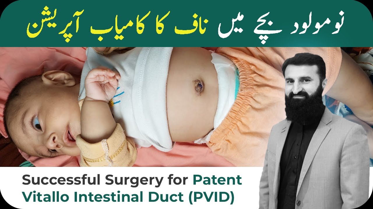 Successful surgery for patient vitallo Intestinal duct (PVID) | Dr Umar Nisar