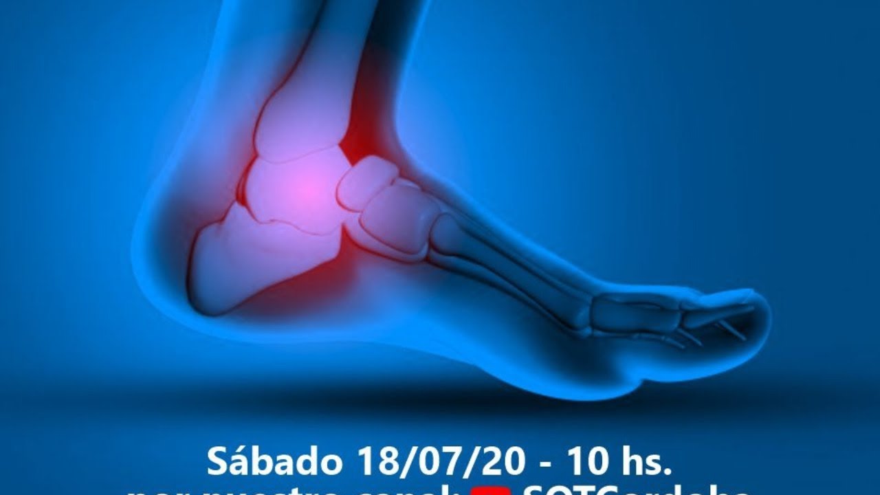 Webinar fracturas maleolares SOTC