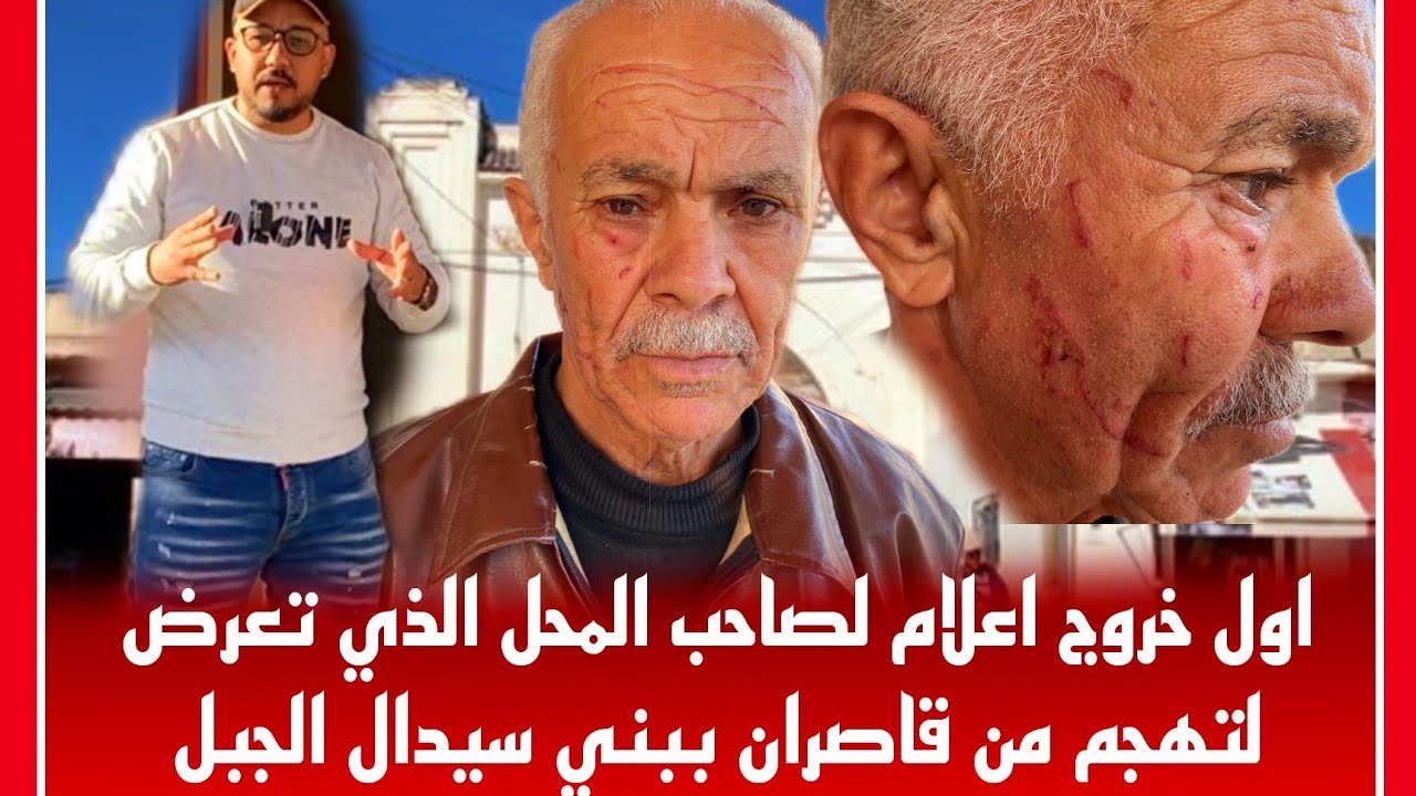 🔴ياربي سلامة😱لعفو ياربي صاحب المحل الذي تعرض للهجوم من قاصران يحكي التفاصيل ببني سيدال الجبل🙄بزاف