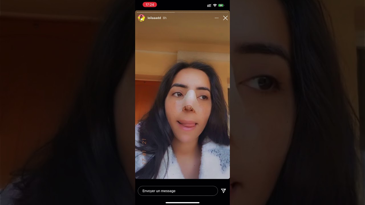 Leila AD se fait refaire le nez : elle parle de sa rhinoplastie
