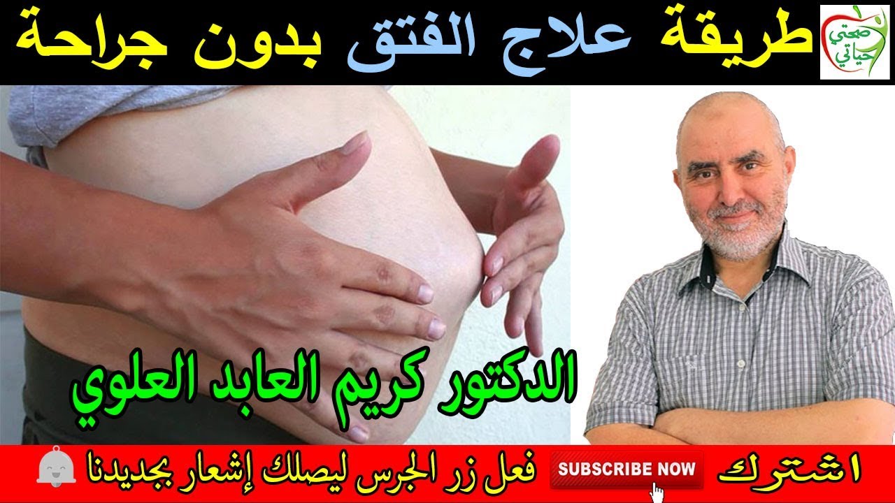 طريقة علاج الفتق بدون جراحة مع الدكتور كريم العابد العلوي