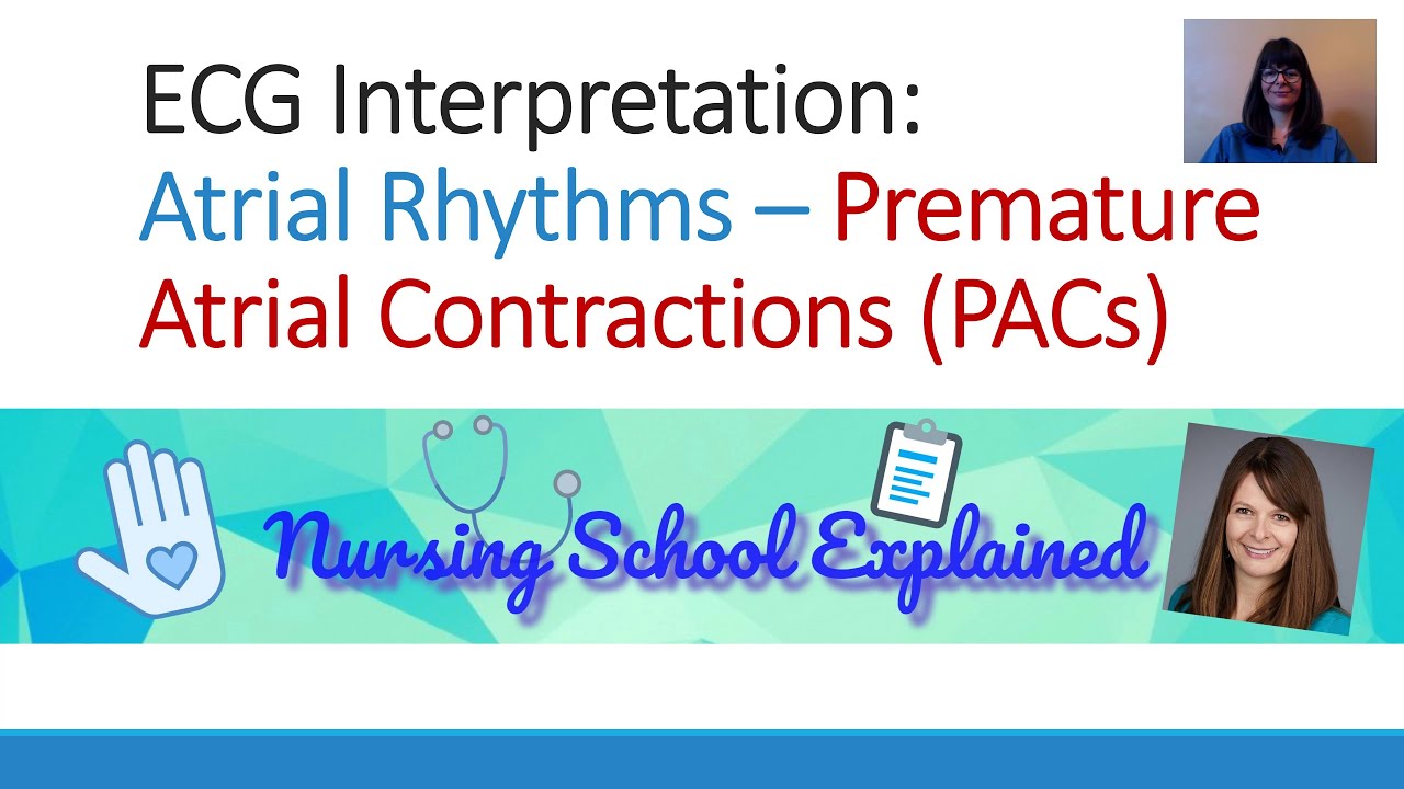 Premature Atrial Contractions (PACs)