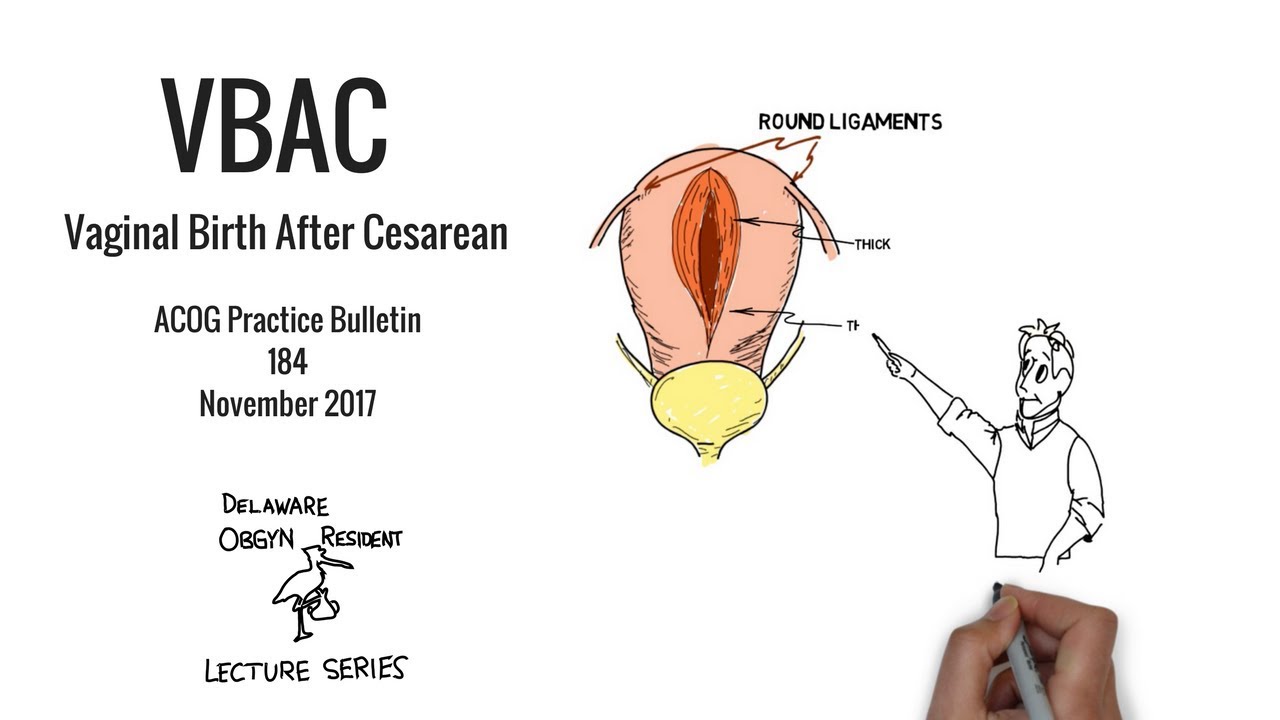 Vaginal Birth After Cesarean; DE OBGYN Resident Lecture Series with James Manley