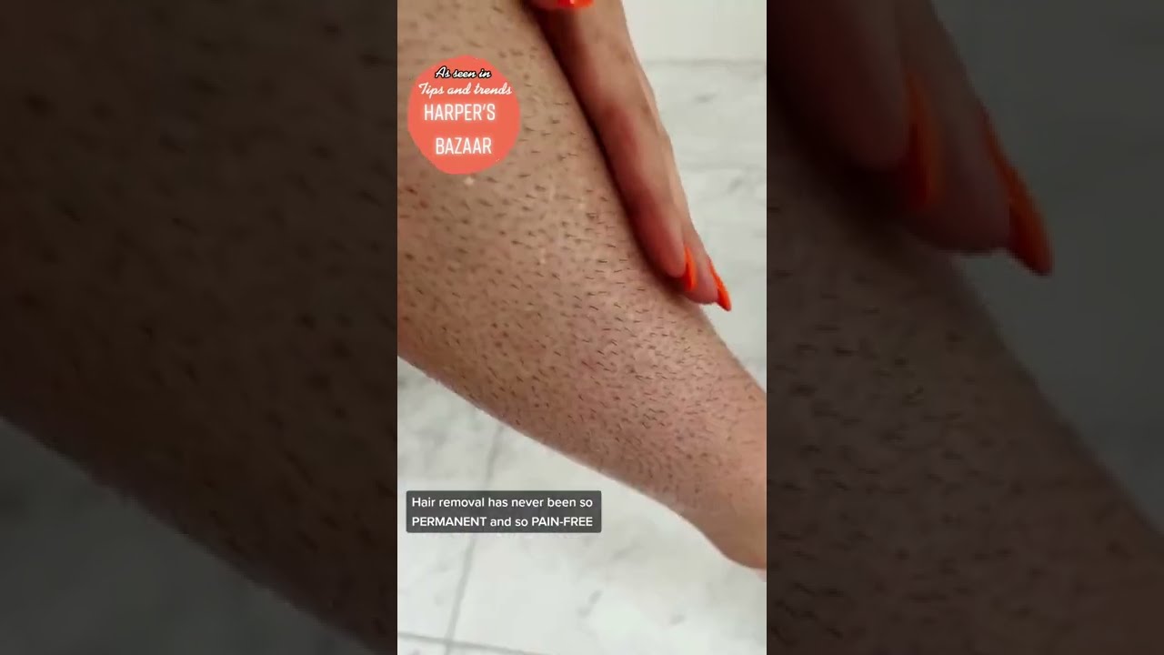 MILA IPL Handset - At Home Laser Hair Removal Handset - Amazon Must Haves