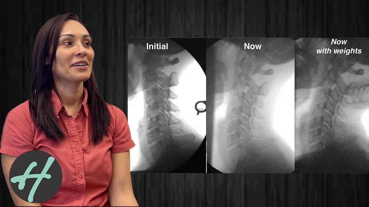 Vertigo, Balance problems, Blurry vision, Curve Correction, Jugular Vein drainage, Cervical Spine
