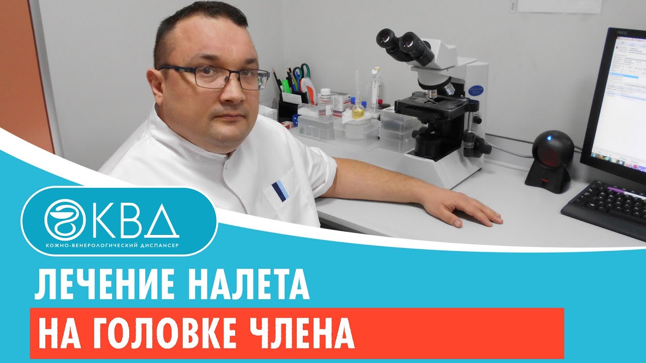💉 Лечение налета на головке члена. Клинический случай №406