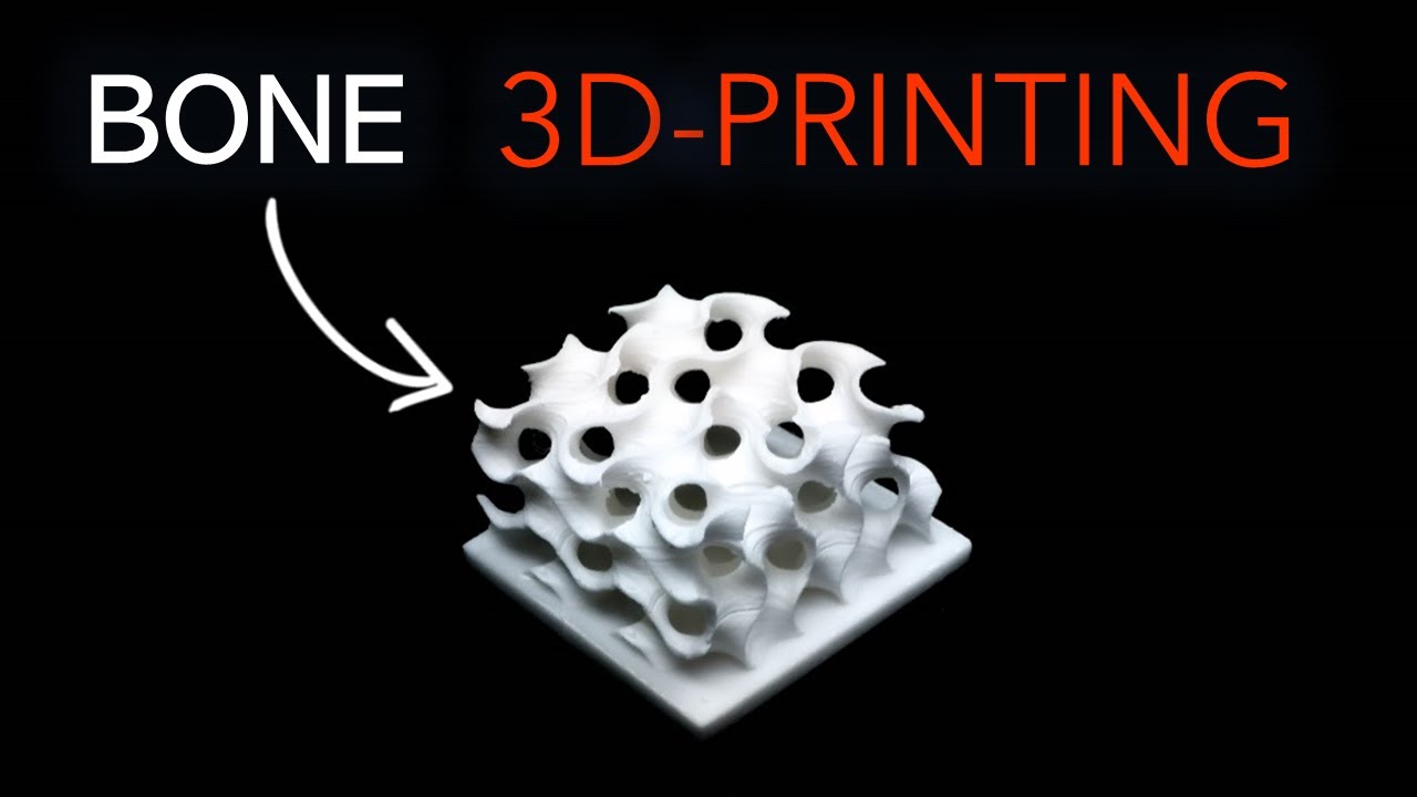 How to 3D-Print Bone Implants - Ceramics Stereolithography