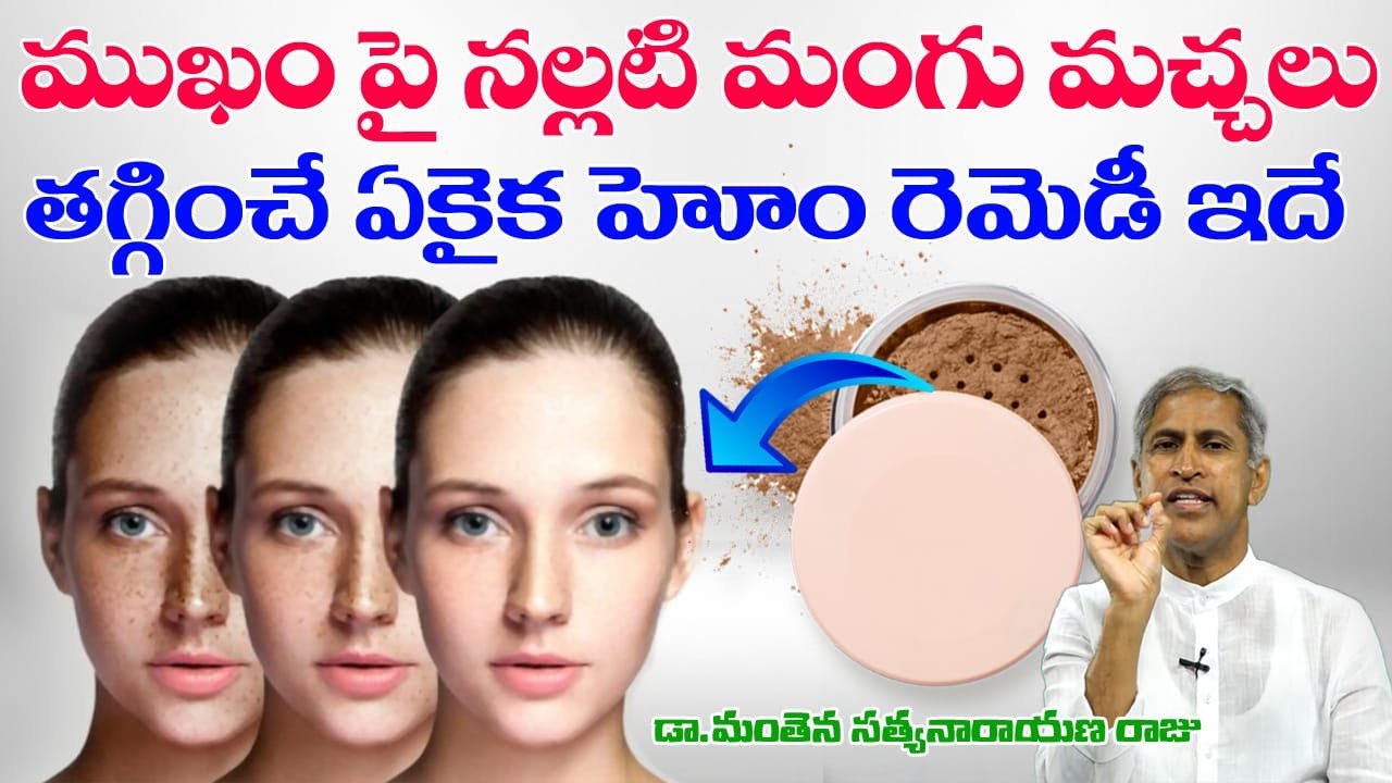 Get Rid of Dark Spots on Face | Honey Massage | Mud Pack | Estrogen | Dr Manthena Satyanarayana Raju