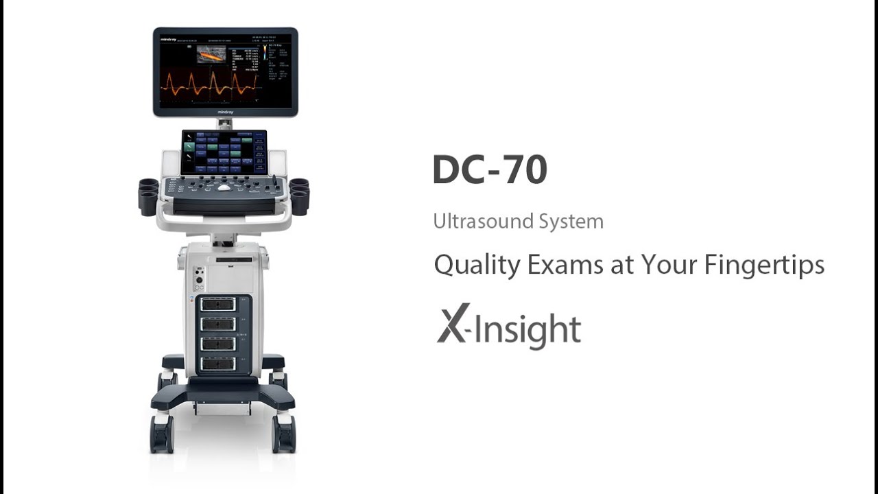 Estudio Cardiológico en Mindray DC-70 X-Insight