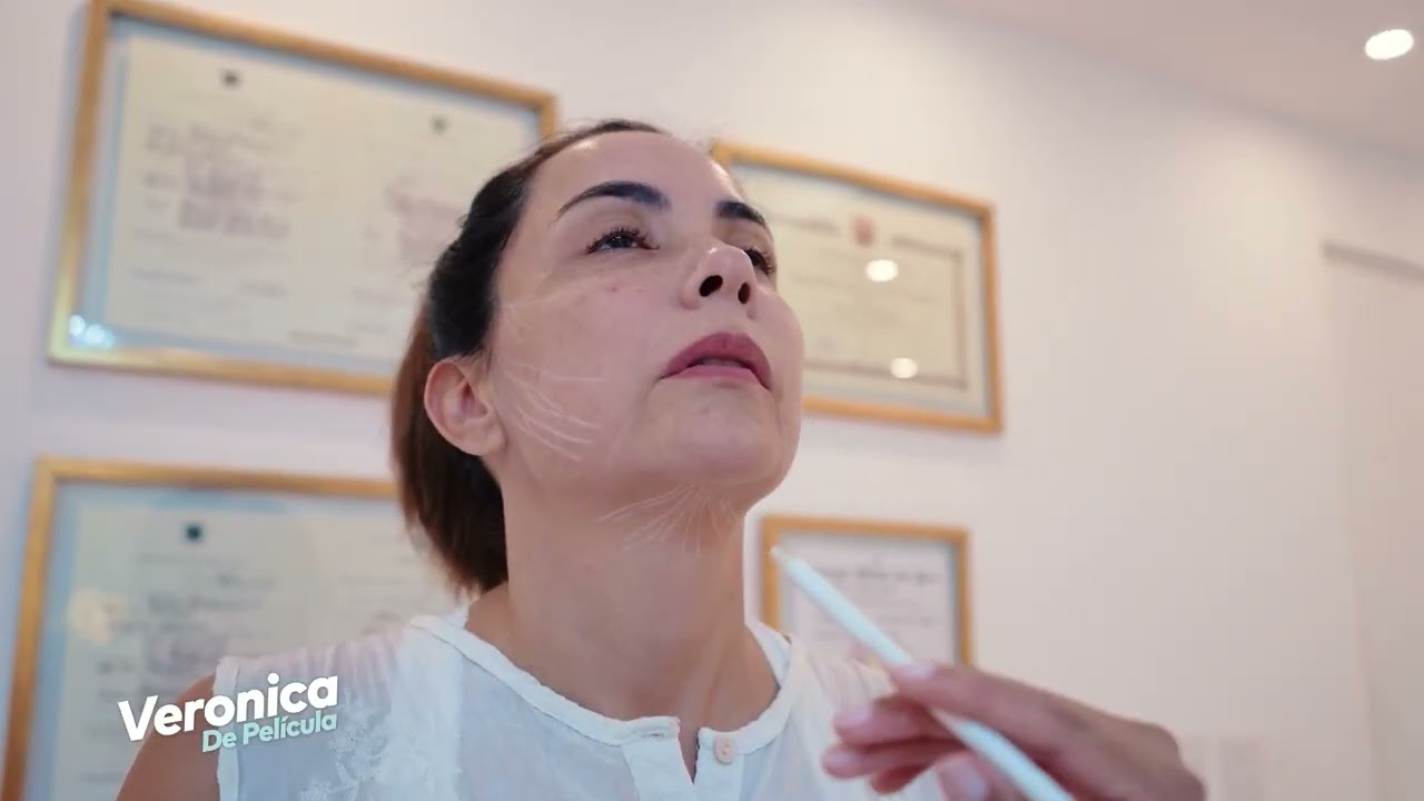 ENDOLIFTING LASER, LIMA, PERU/ DRA. DENNISSE ARROYO