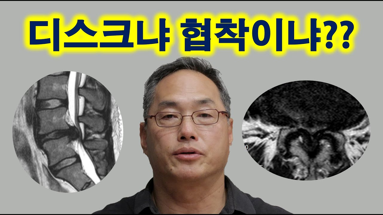 디스크냐 협착이냐