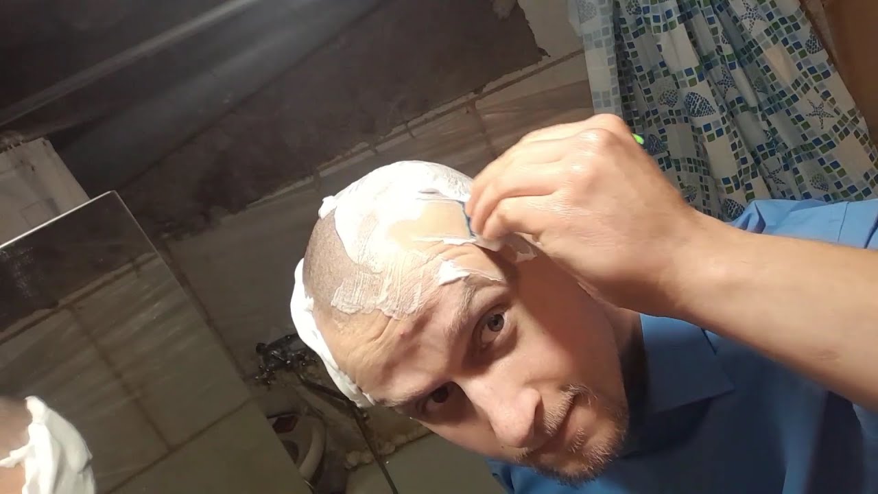 Shaving My Head After 48 Hours