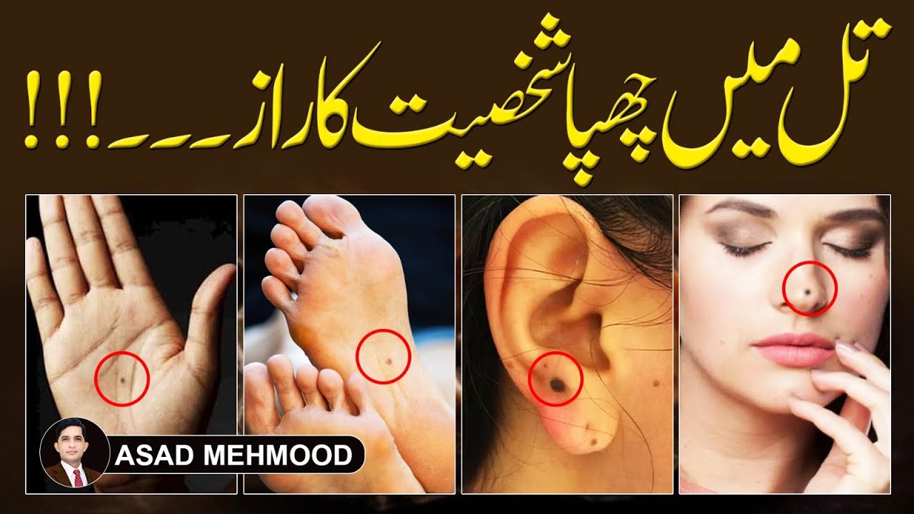 Spiritual Secrets Behind Moles on Your Body | Islamic Learning Hub