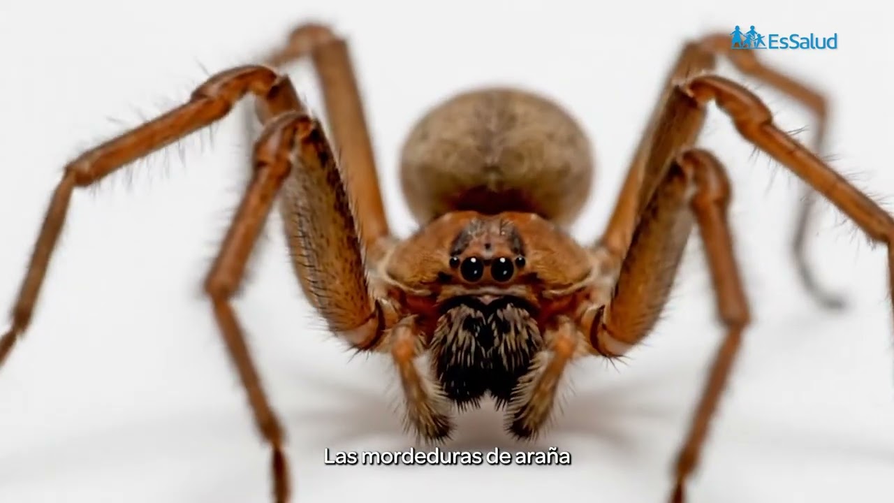 ¿Qué hacer si te muerde una araña? 🕷️
