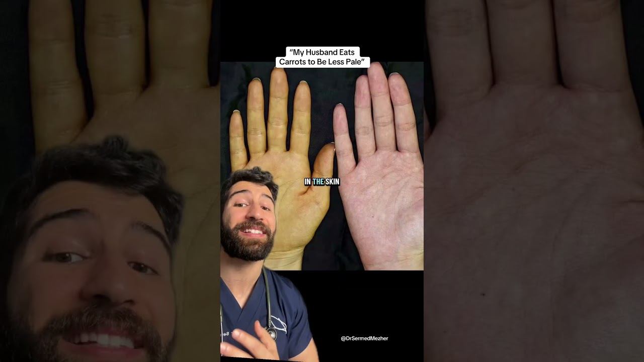 Doctor Explains Getting a &ldquo;Carrot Tan&rdquo;