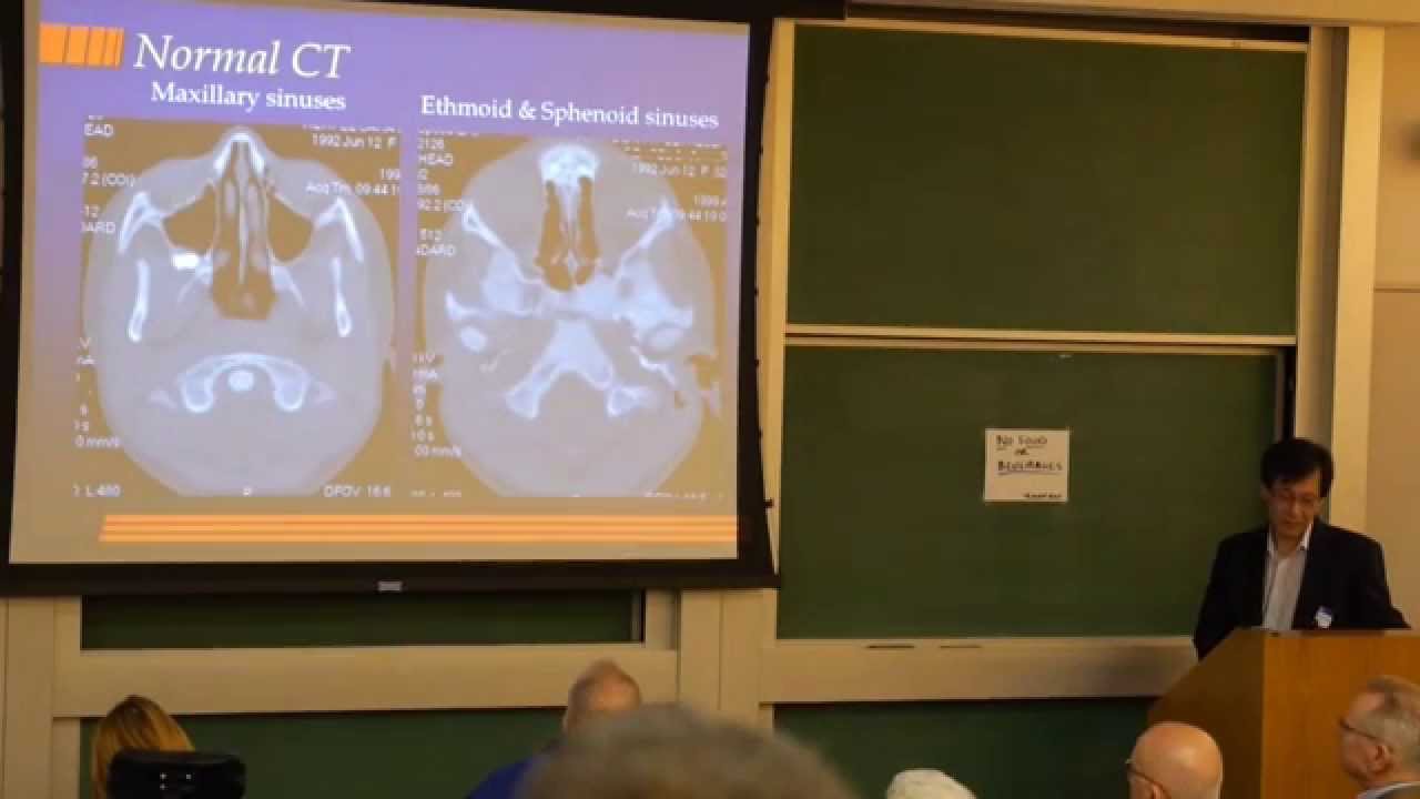 Craniofacial (ENT) Care of Fibrous Dysplasia