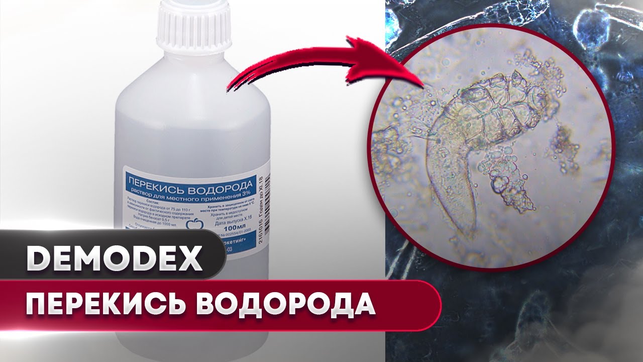 🐛 Купание демодекс клеща в перекиси водорода 3% &ndash; эксперимент под микроскопом! 🔬🫧