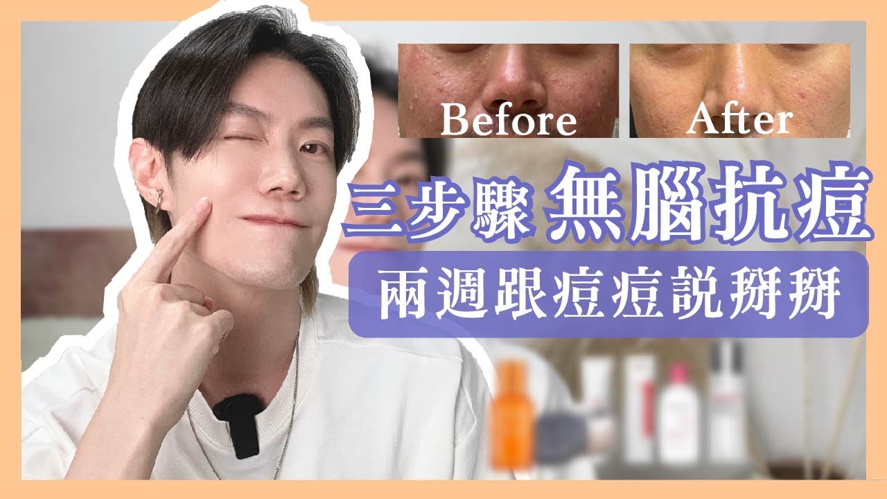 抗痘不用花大錢💰照著做就對了❗️風險最小、效果最好的抗痘保養SOP