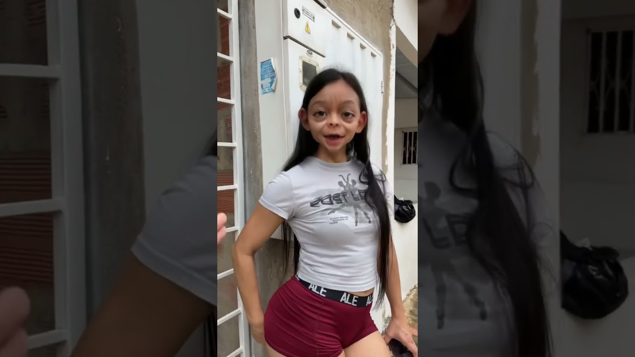 Couple Goals Gone Wrong 😂 | Funny Love Story 2025