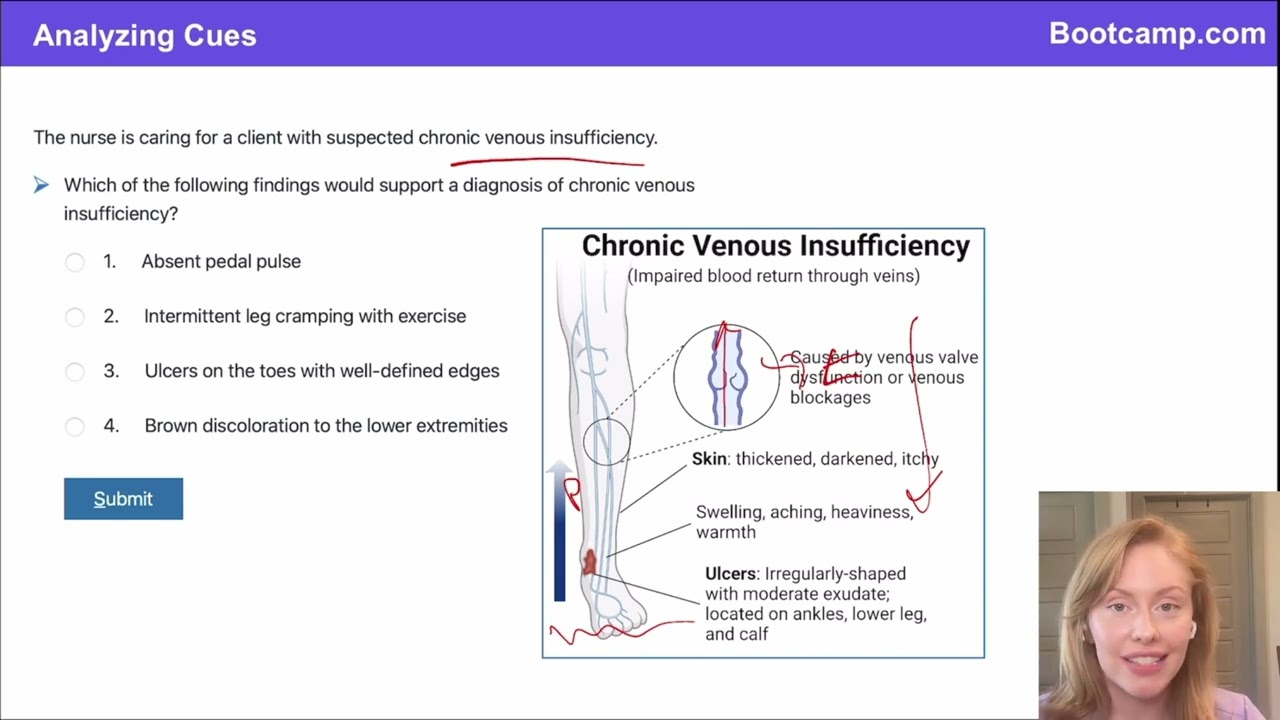 Chronic Venous Insufficiency (CVI) vs Peripheral Artery Disease (PAD): Understanding the Differences