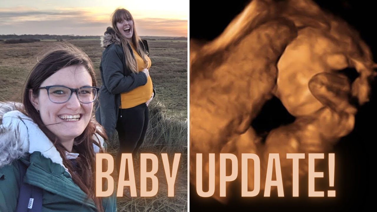 24 WEEKS PREGNANT! (Live Scan Footage AND Bump Shot!) | Lesbian IVF Pregnancy - UK