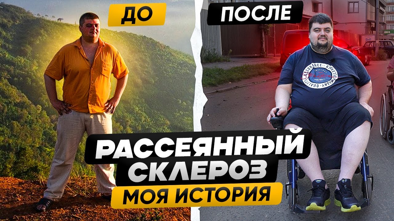 НЕМЕЛА РУКА, а оказалось Рассеянный Склероз: МОЯ ИСТОРИЯ