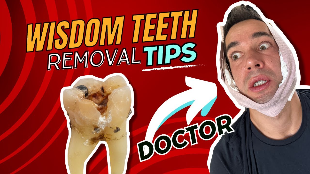 I got my wisdom teeth removed! 😱 -TOP TIPS from a Doctor on surgery and wisdom teeth recovery