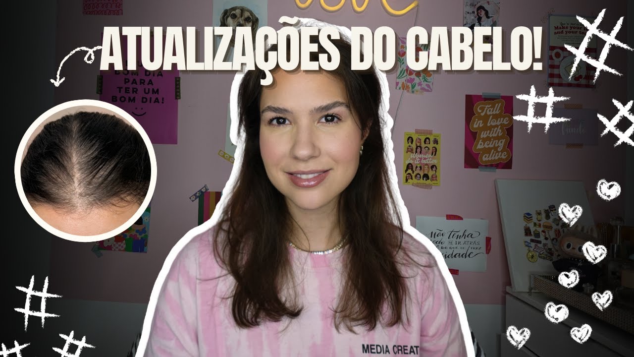 MAQUIA E FALA: Alopécia Androgenética e DIU Mirena