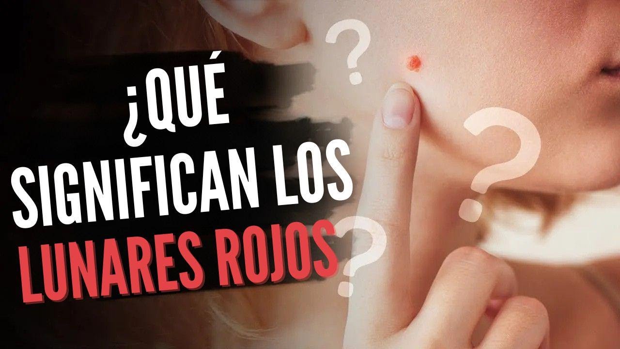 &iquest;Qu&eacute; significan las manchas rojas en la piel?