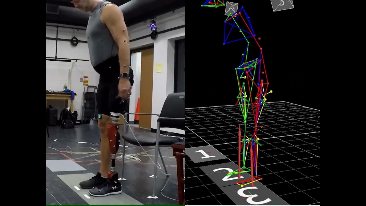 Biomechanics of sit to stand transitions with a powered knee ankle prosthesis