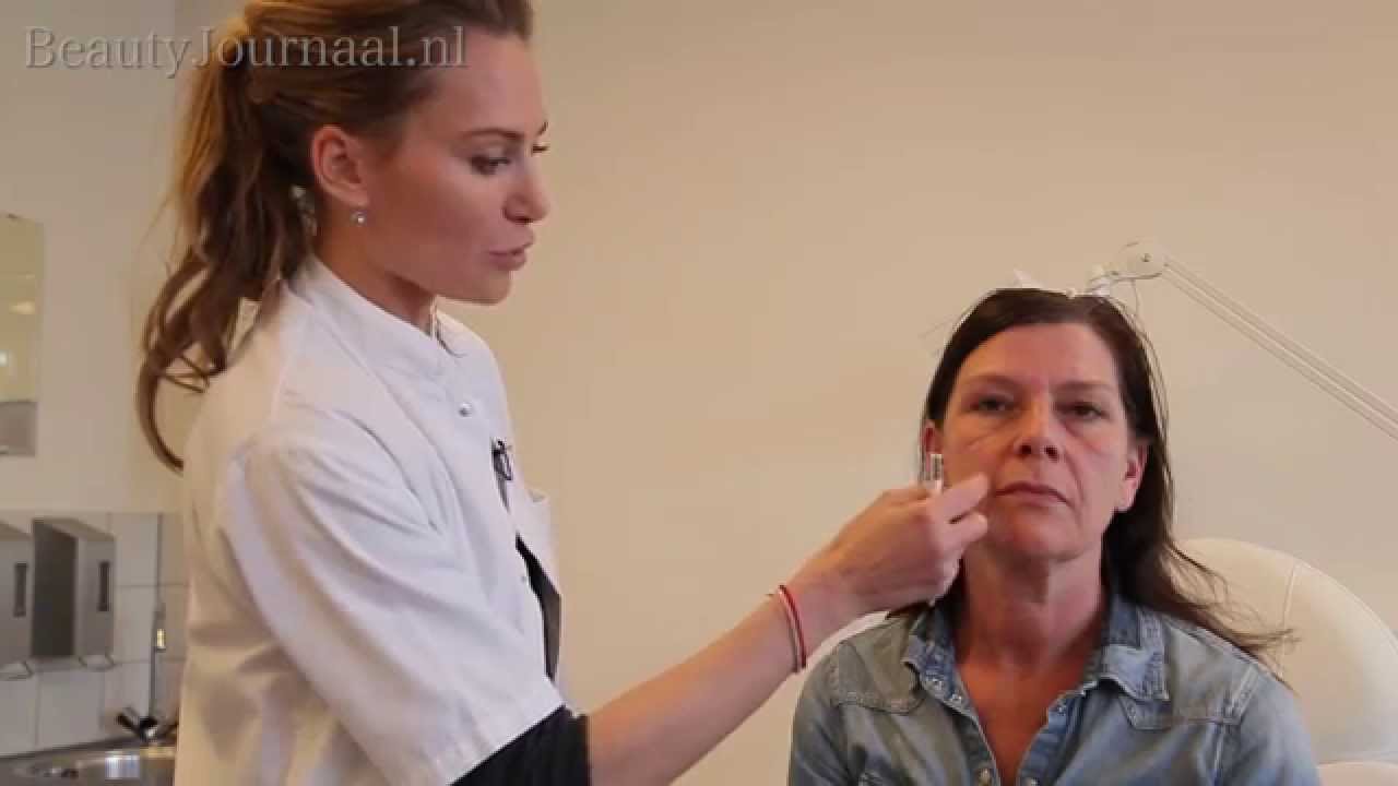 Drs Floor Claus doet een liquid facelift