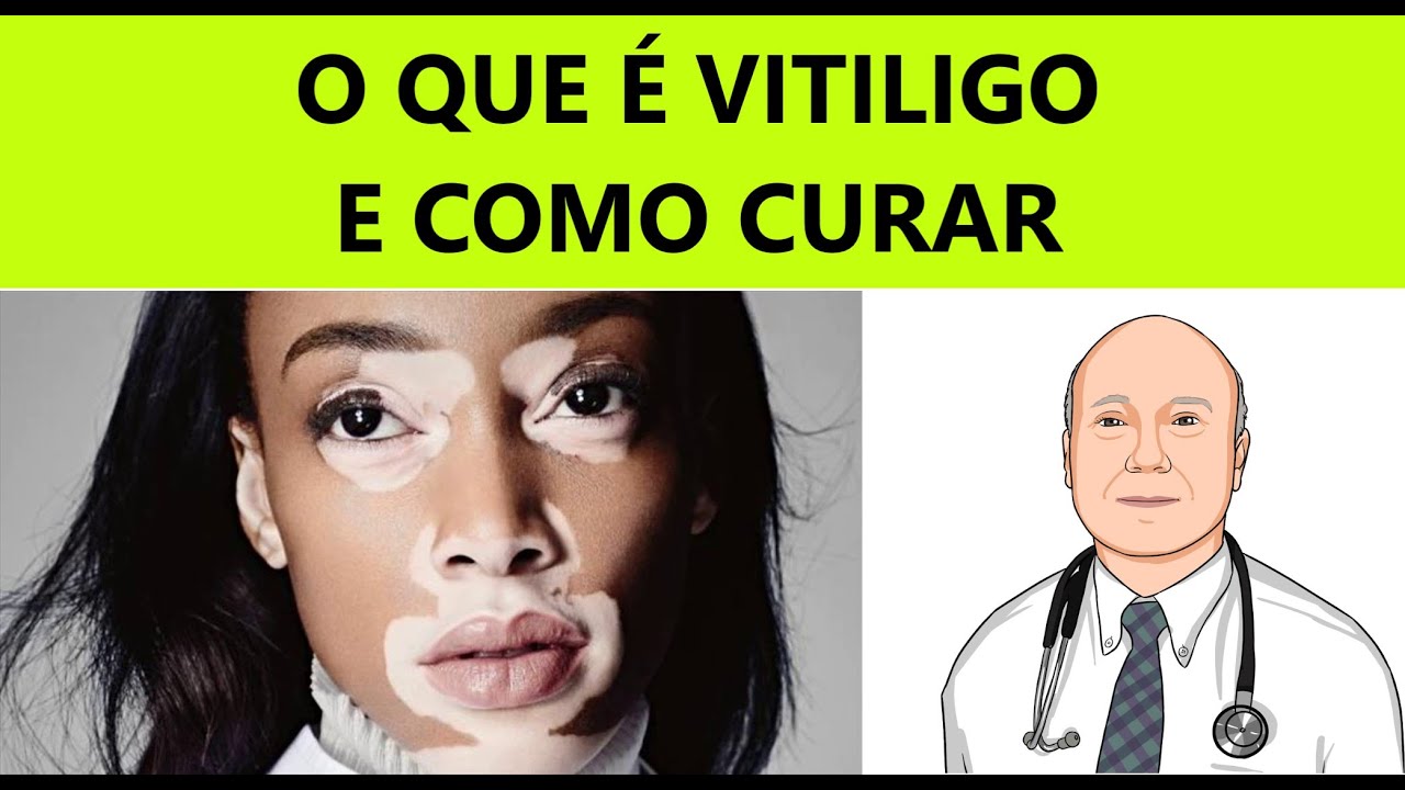 Manchas brancas na pele e pelos: o que é vitiligo, como tratar e (talvez) curar.