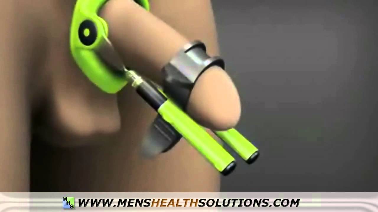 Male Edge   safe, natural and painless penis enlargement exercices