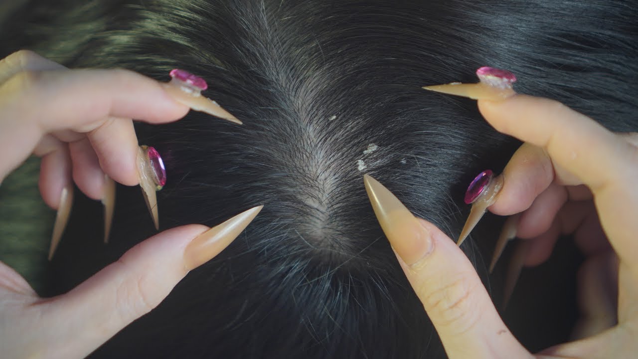 ASMR Scalp Check, Gentle Scalp Scratching With Long Nails For Sleep Aid ( Tingles )