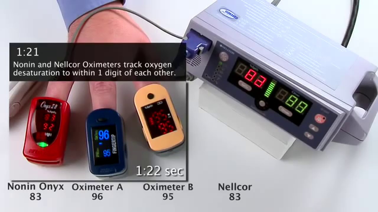 Onyx Vantage 9590 Pulse Oximeter vs the Competition