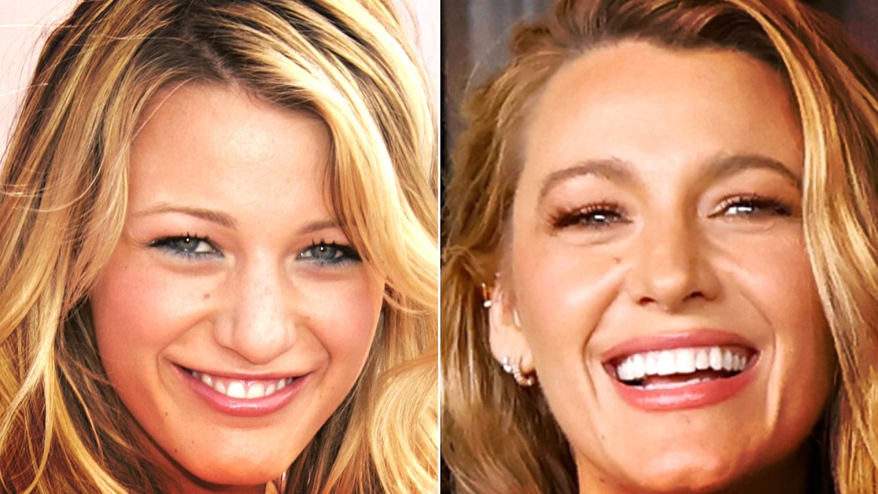 Celebs Who Only Hit The Big Time After Plastic Surgery