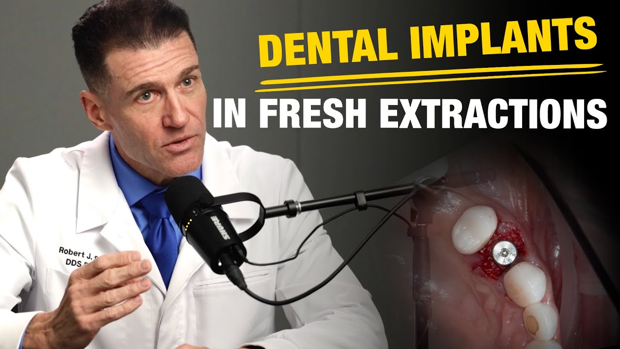 How to Place Implants into Fresh Extraction Sites