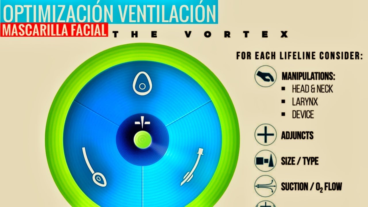MANEJO VÍA AÉREA CON VÓRTEX (OPTIMIZACIÓN VENTILACIÓN CON MASCARILLA FACIAL