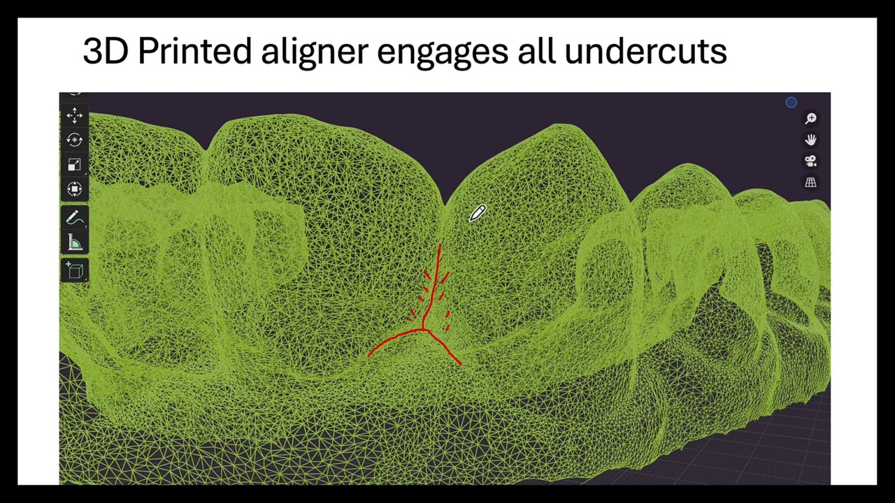 3d printed vs thermoformed